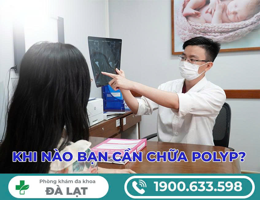 Hình ảnh minh họa